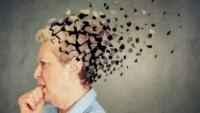 مراحل الزهايمر